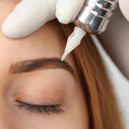 Eyebrow procedure