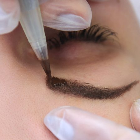 Eyebrow procedure